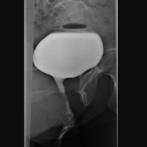 Cystographie