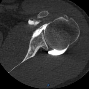 Arthroscanner