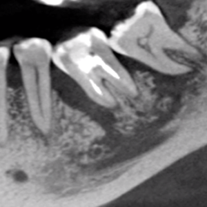 Cone beam