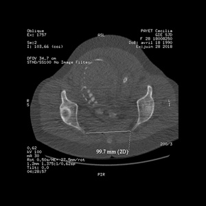 Pelvi‑scanner