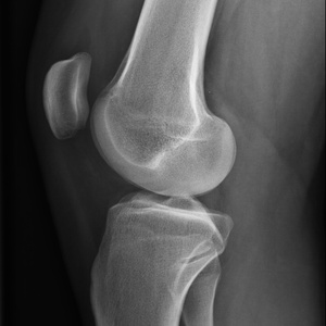 Radiographie standard