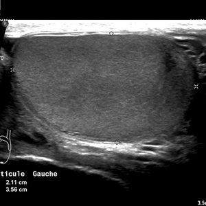 Testiculaire